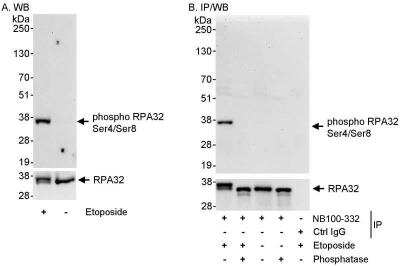 Western Blot: RPA2 [p Ser4, p Ser8] Antibody [NBP1-23017]